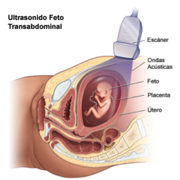 ecocardiograma fetal 1